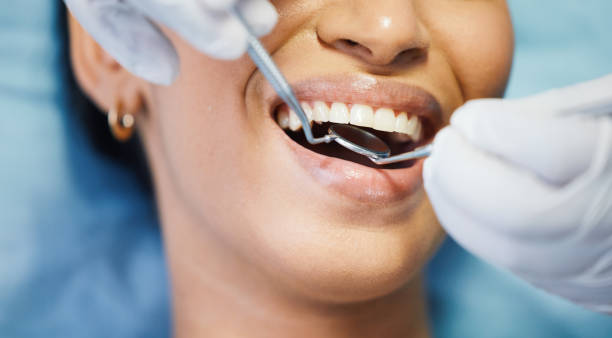 Best Broken or Chipped Tooth Repair in Bridgehampton, NY
